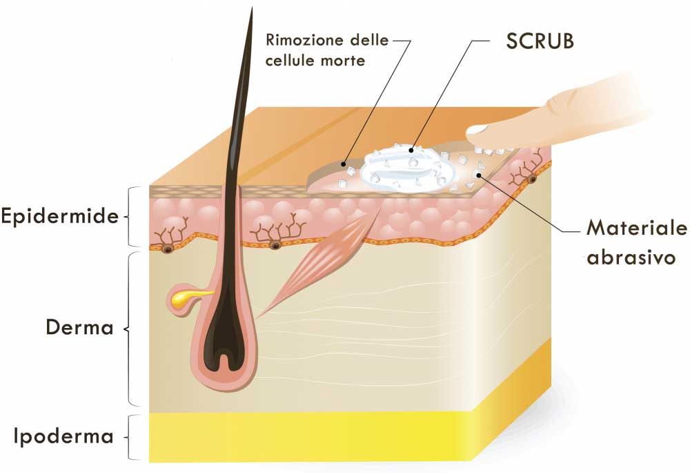 Scrub - Come Funziona