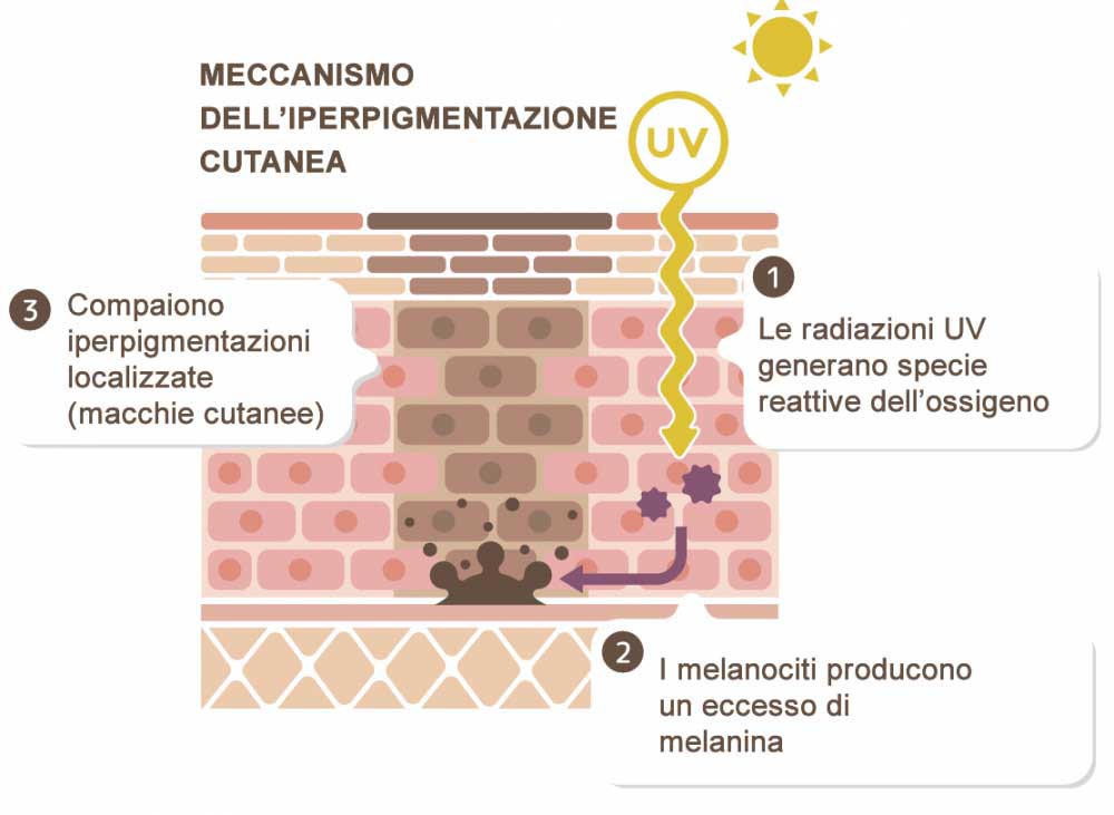 Melanina e  macchie della pelle