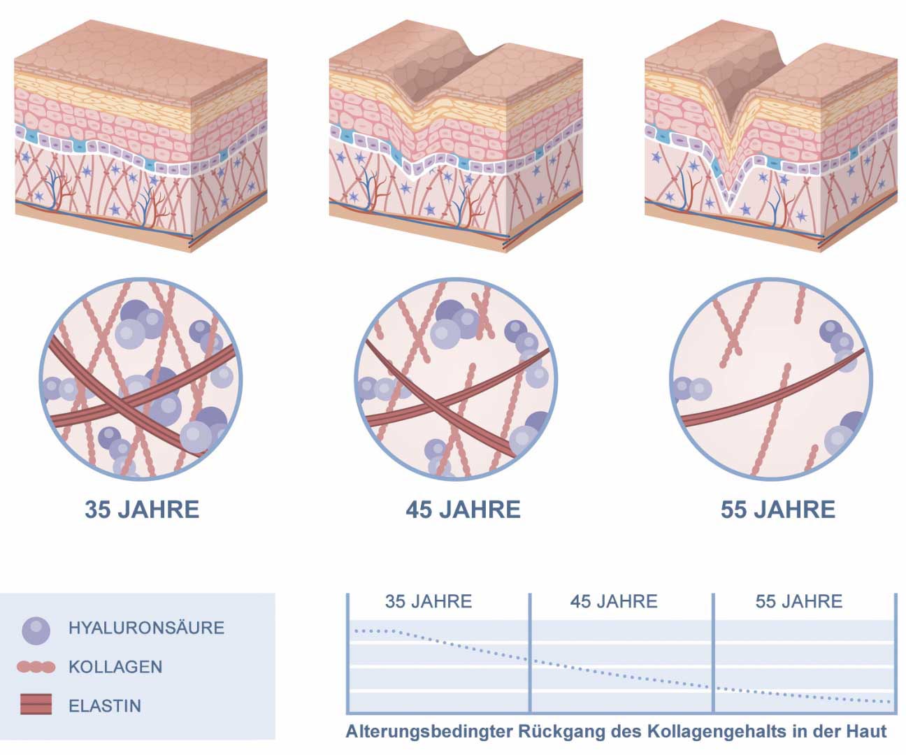 alterndes kollagen