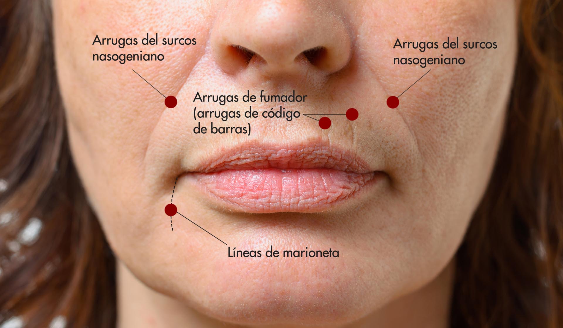 arrugas labios