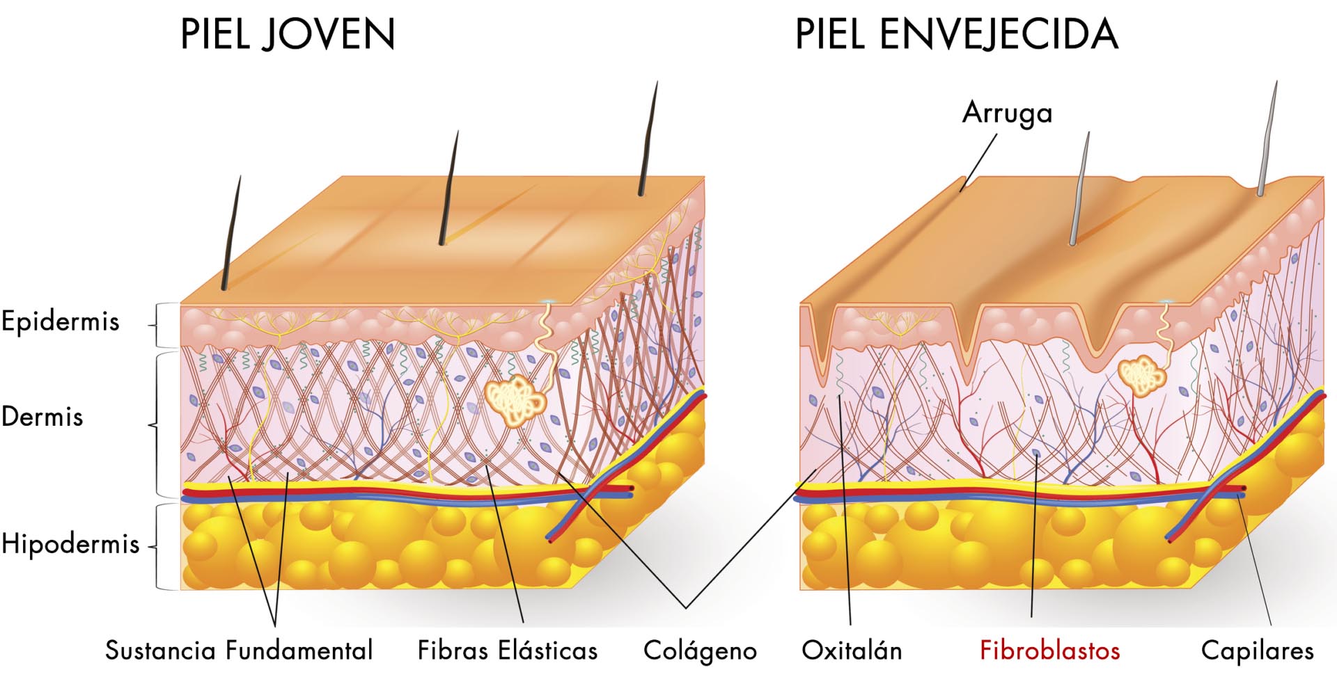 Fibroblastos