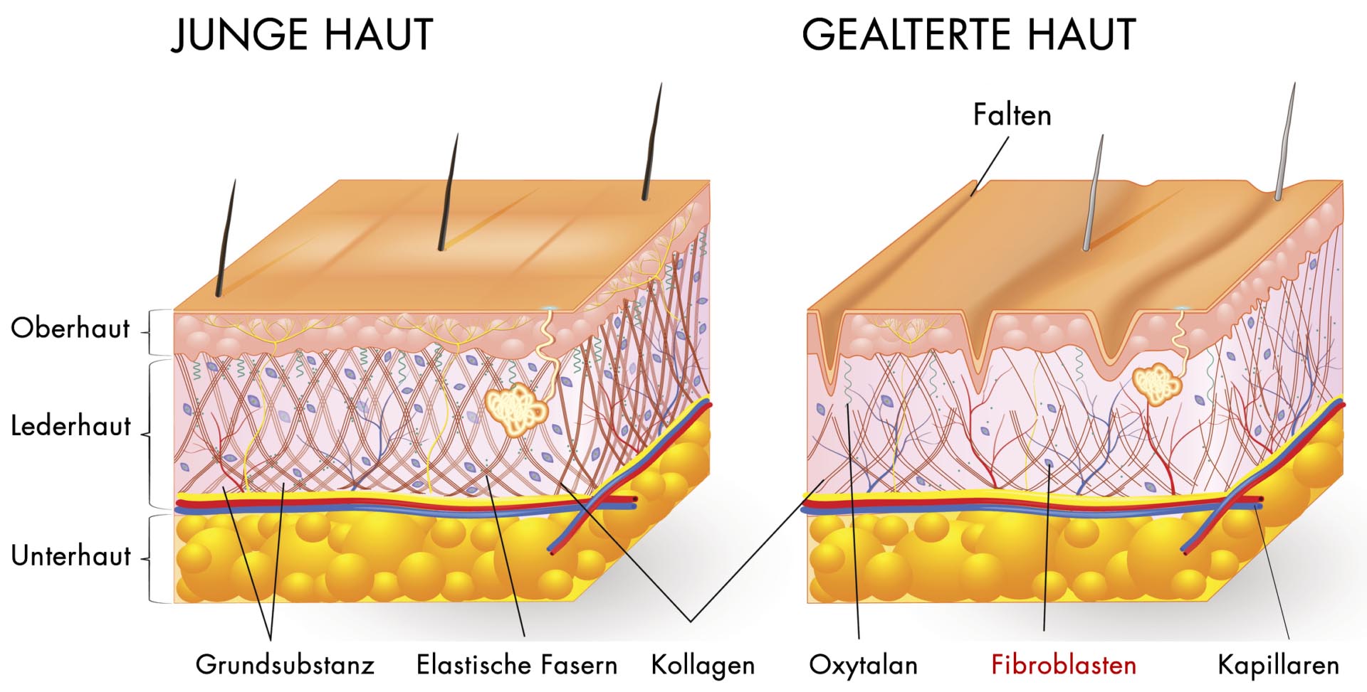 fibroblasten