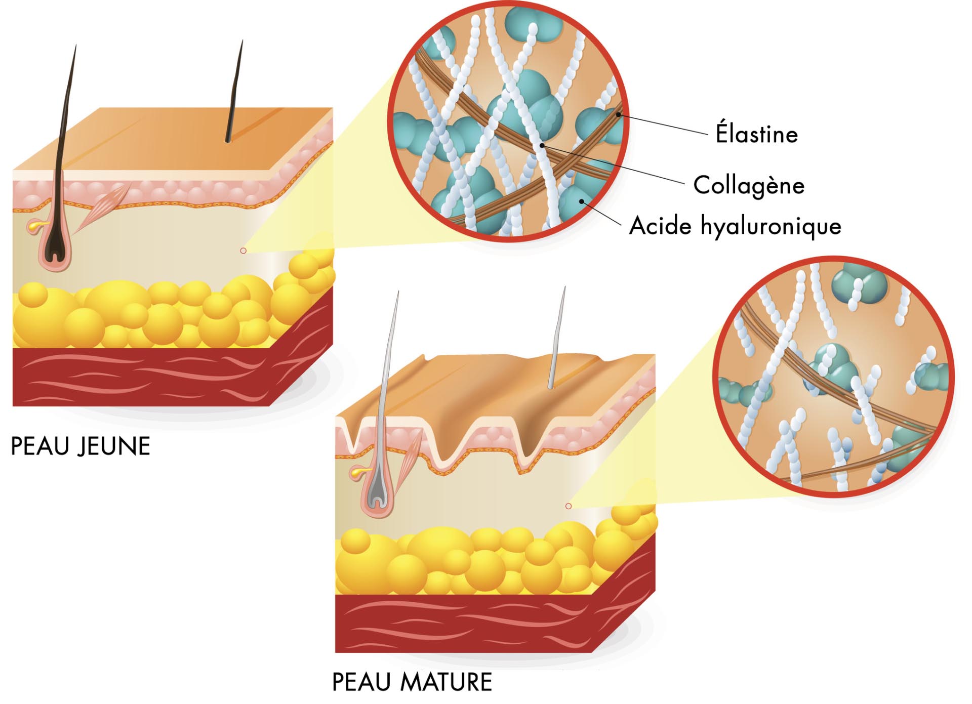 collagene acide hyaluronique