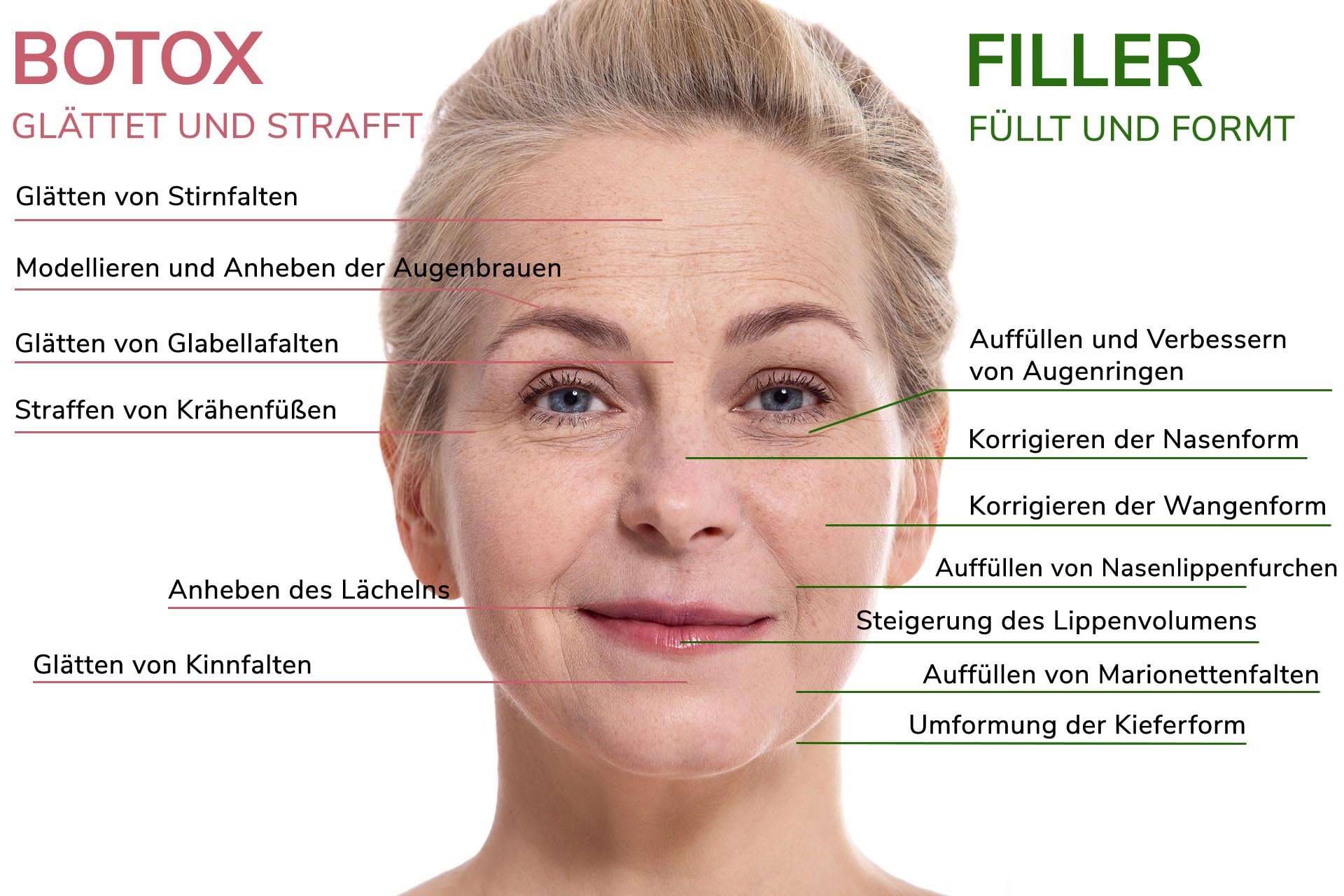 Filler oder Botox