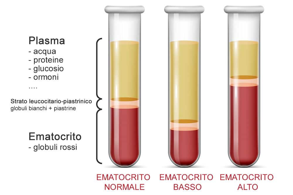 ematocrito basso