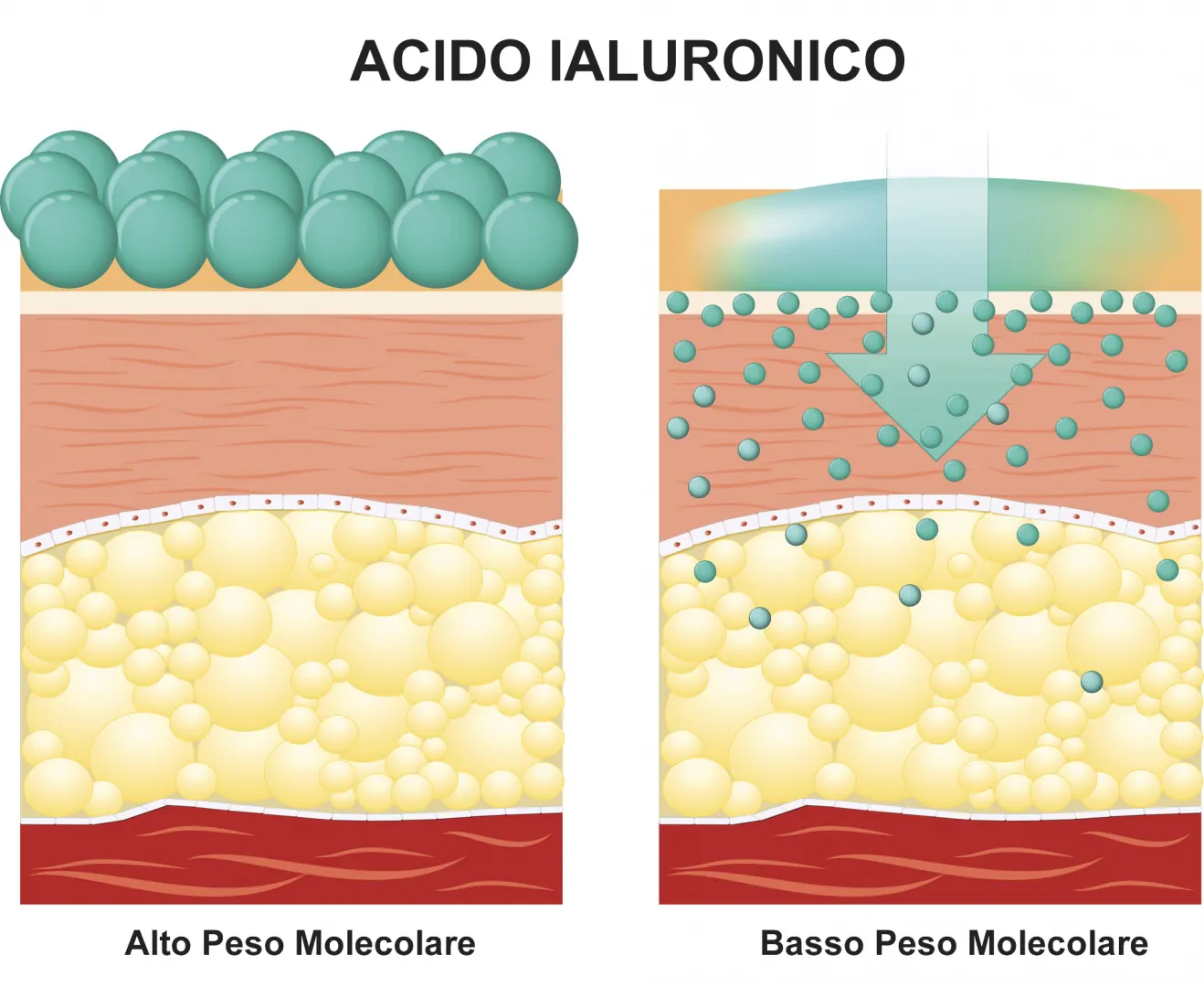 Acido Ialuronico Penetrazione