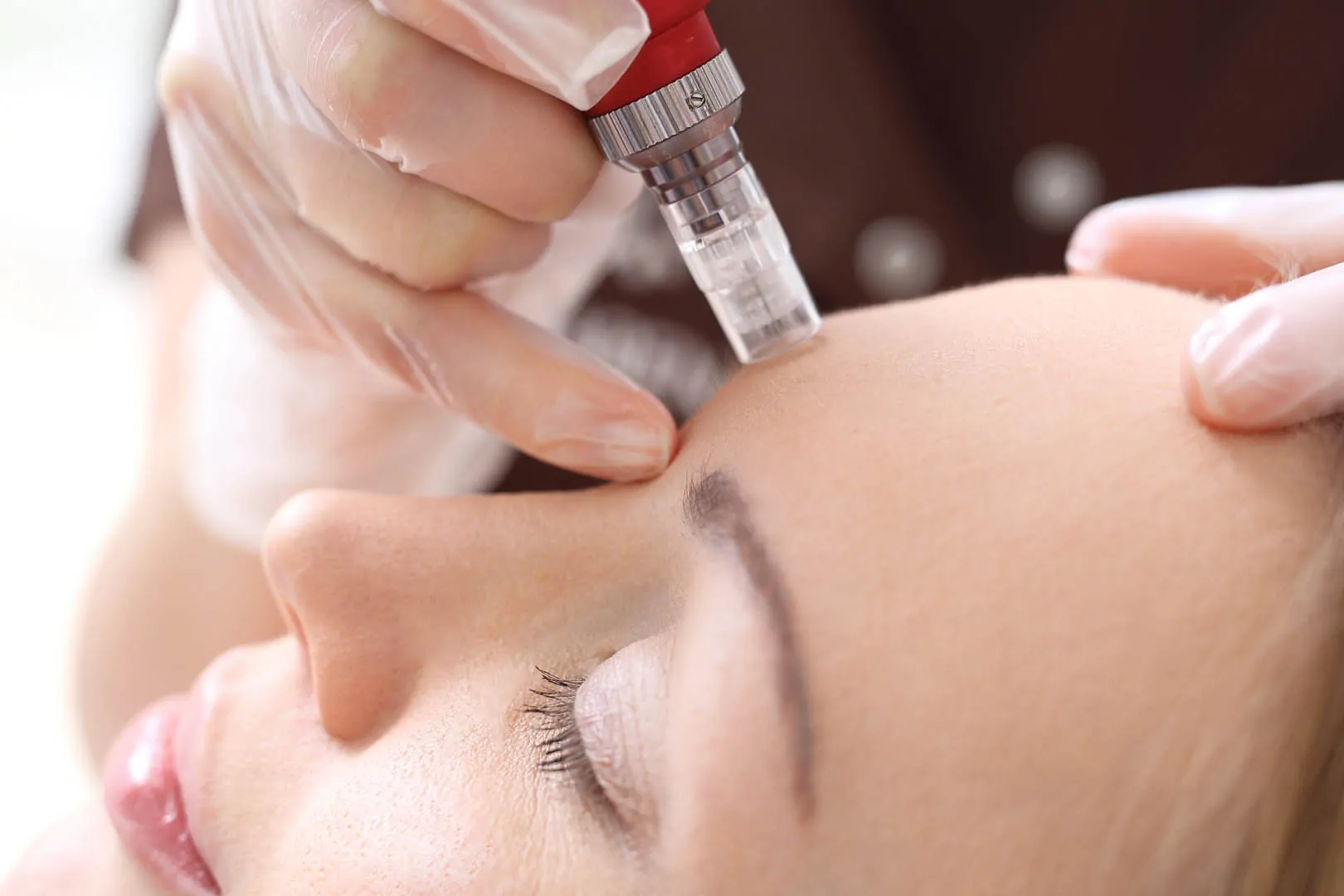 Mesotherapie