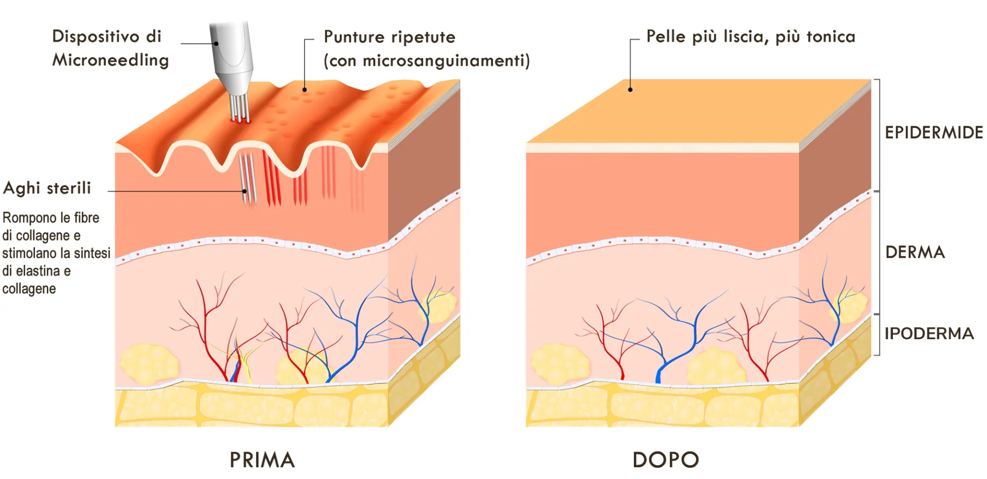 microneedling come funziona