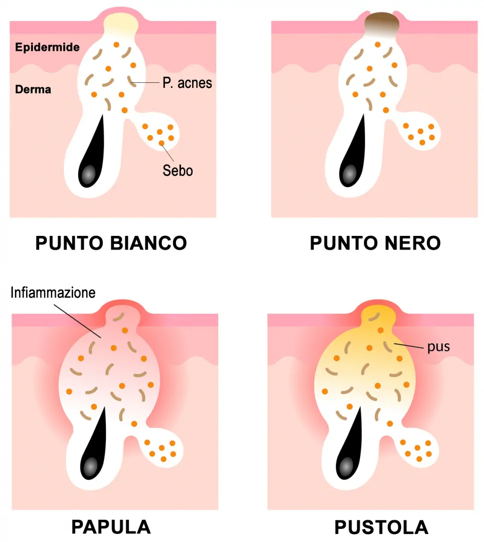 Punti Bianchi e Neri