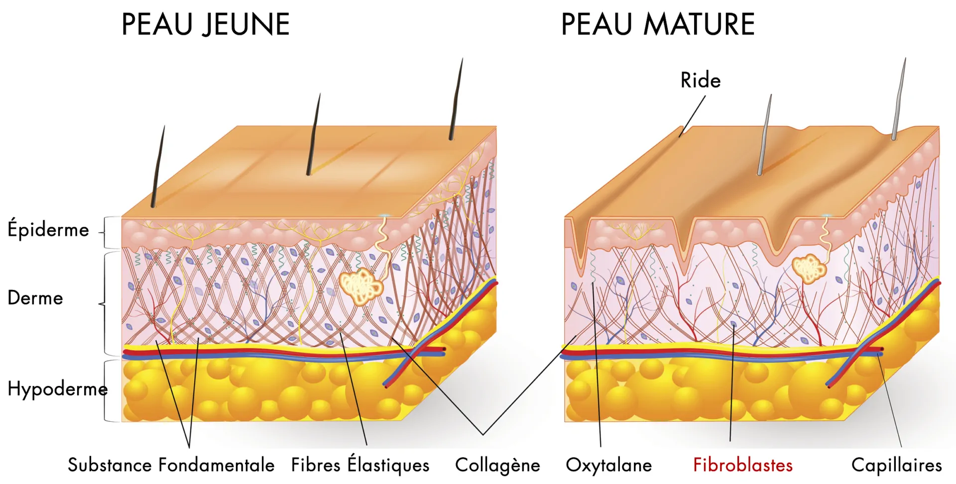 fibroblaste 