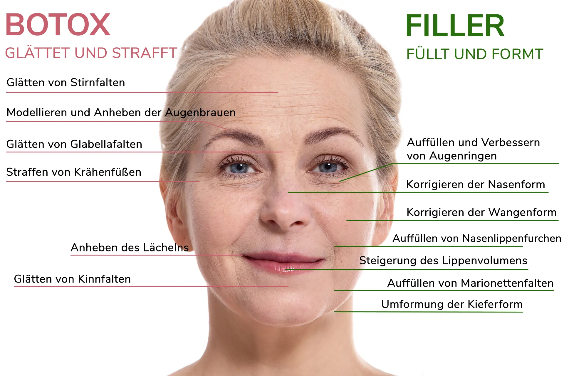 Filler oder Botox